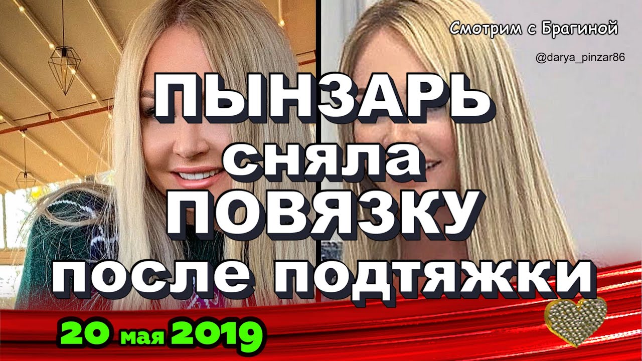 Pynzar-snyala-POVYAZKU-posle-PLASTIKI-DOM-2-novosti-na-20-maya-2019